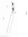 Fig. 08 - Miniature implantable device and methods