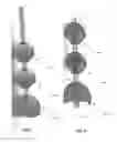 Fig. 04 - Intracavity balloon catheter