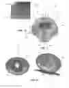Fig. 06 - Intracavity balloon catheter