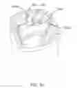 Fig. 06 - GOLF BAG SAVER