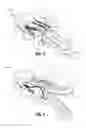 Fig. 04 - Wrist and jaw assemblies for robotic surgical systems