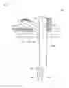 Fig. 08 - PORTAL-SHAPED TEAR PROCESSING DEVICE