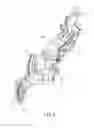 Fig. 05 - Bicycle rear derailleur
