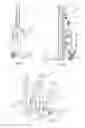 Fig. 02 - Method for the set-up and control of a lift system