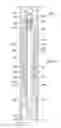 Fig. 03 - Wellbore isolation devices with degradable non-metallic components