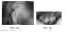 Fig. 02 - Stable encapsulated fragrance compositions