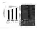 Fig. 06 - In vitro model for blood-brain barrier and method for producing in vitro model for blood-brain barrier