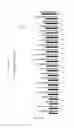 Fig. 79 - MODIFIED TGF-BETA OLIGONUCLEOTIDE FOR USE IN A METHOD OF PREVENTING AND/OR TREATING AN OPHTHALMIC DISEASE