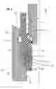 Fig. 03 - Subsea system with landing indication
