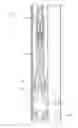 Fig. 01 - Apparatus and method for cutting casings