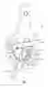 Fig. 07 - Vehicle braking systems with automatic slack adjusters