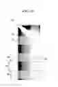 Fig. 20 - Display device having reflecting sheet with plurality of dot areas reducing reflectivity of the reflecting sheet