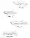 Fig. 09 - APPARATUS FOR SUPPORTING EXPANSION TANK