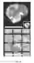 Fig. 08 - Methods for reversible and tunable tissue magnification