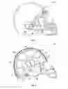 Fig. 02 - SYSTEMS AND METHODS FOR HELMET LINER EVALUATION