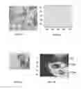 Fig. 28 - Method and system for detection of disease agents in blood
