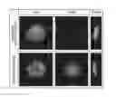 Fig. 01 - Method for evaluating protrusion-forming ability of cell spheroids