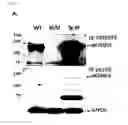 Fig. 04 - Nucleic acids encoding antibodies with high affinity for Alpha-Klotho