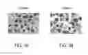 Fig. 04 - METHODS AND SYSTEMS FOR IDENTIFYING AND TREATING ANTI-PROGESTIN SENSITIVE TUMORS