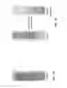 Fig. 02 - Methods for testing effectiveness of a von Willebrand factor used in treating von Willebrand disease (VWD)