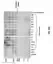 Fig. 19 - Methods for testing effectiveness of a von Willebrand factor used in treating von Willebrand disease (VWD)