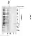 Fig. 20 - Methods for testing effectiveness of a von Willebrand factor used in treating von Willebrand disease (VWD)