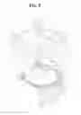 Fig. 09 - Lens moving apparatus