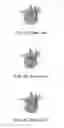 Fig. 02 - Systems and methods for assisting a surgeon and producing patient-specific medical devices