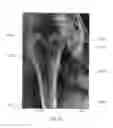 Fig. 16 - MEDICAL IMAGE ANALYSIS