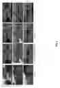 Fig. 17 - 