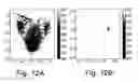 Fig. 13 - Matching network for medical image analysis