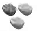Fig. 01 - Method for estimating at least one of shape, position and orientation of a dental restoration