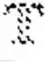 Fig. 02 - Method for estimating at least one of shape, position and orientation of a dental restoration