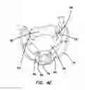 Fig. 10 - Hysterectomy model