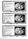 Fig. 08 - METHOD AND SYSTEM FOR RADIOLOGY REPORTING