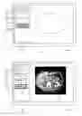 Fig. 11 - METHOD AND SYSTEM FOR RADIOLOGY REPORTING