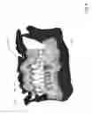 Fig. 05 - Method and system of teeth alignment based on simulating of crown and root movement