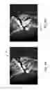 Fig. 07 - Method and system of teeth alignment based on simulating of crown and root movement