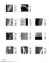 Fig. 08 - Method and system of teeth alignment based on simulating of crown and root movement