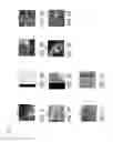 Fig. 09 - Method and system of teeth alignment based on simulating of crown and root movement