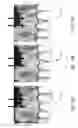 Fig. 16 - Method and system of teeth alignment based on simulating of crown and root movement