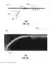 Fig. 07 - Methods and apparatus for adjusting an operational characteristic of an antenna
