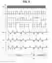 Fig. 07 - Baud rate modulating magnetic stripe data transmitter, system, and method