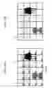 Fig. 11 - Apparatus for generating and displaying a focus assist image indicating a degree of focus for a plurality of blocks obtained by dividing a frame of image signal