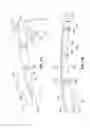 Fig. 02 - ARMRESTS INCLUDING ONE OR MORE LAMINATES AND METHODS AND KITS FOR MAKING THE SAME
