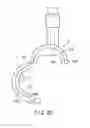 Fig. 23 - Washing tool and endoscope system