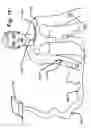 Fig. 12 - Medical device position location systems, devices and methods