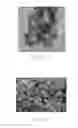 Fig. 07 - Glucose sensor apparatus addressing interference of ascorbic acid and acetaminophen