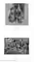 Fig. 07 - Glucose-sensing device with maltose blocking layer