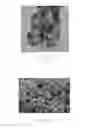 Fig. 07 - Non-enzymatic glucose-sensing device with nanoporous structure and conditioning of the nanoporous structure